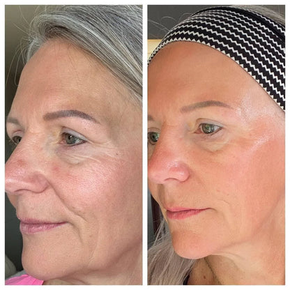 Afinelle™ Cepillo facial linfático